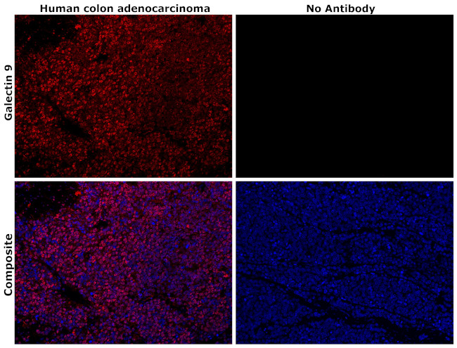 Galectin 9 Antibody in Immunohistochemistry (Paraffin) (IHC (P))