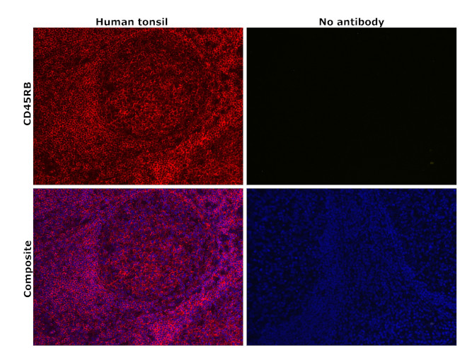 CD45RB Antibody in Immunohistochemistry (Paraffin) (IHC (P))