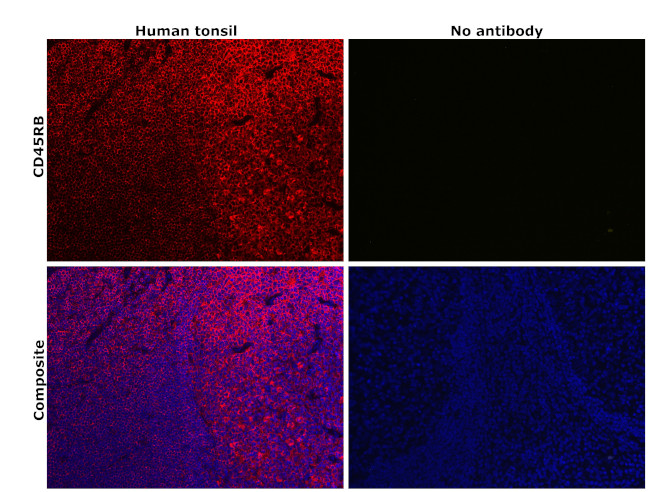 CD45RB Antibody in Immunohistochemistry (Paraffin) (IHC (P))