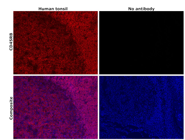 CD45RB Antibody in Immunohistochemistry (Paraffin) (IHC (P))