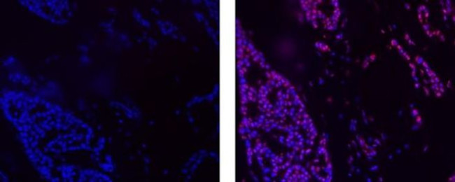 Cyclin E Antibody in Immunohistochemistry (Paraffin) (IHC (P))