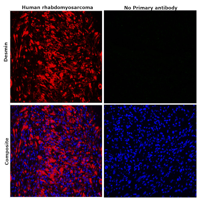 Desmin Antibody in Immunohistochemistry (Paraffin) (IHC (P))