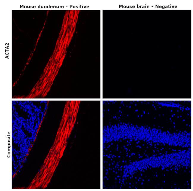 Desmin Antibody in Immunohistochemistry (Paraffin) (IHC (P))