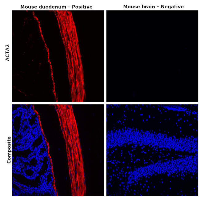 Desmin Antibody