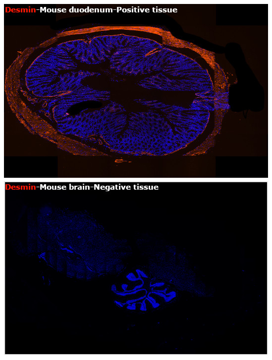 Desmin Antibody