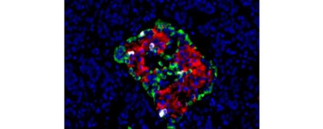 Somatostatin Antibody in Immunohistochemistry (Paraffin) (IHC (P))