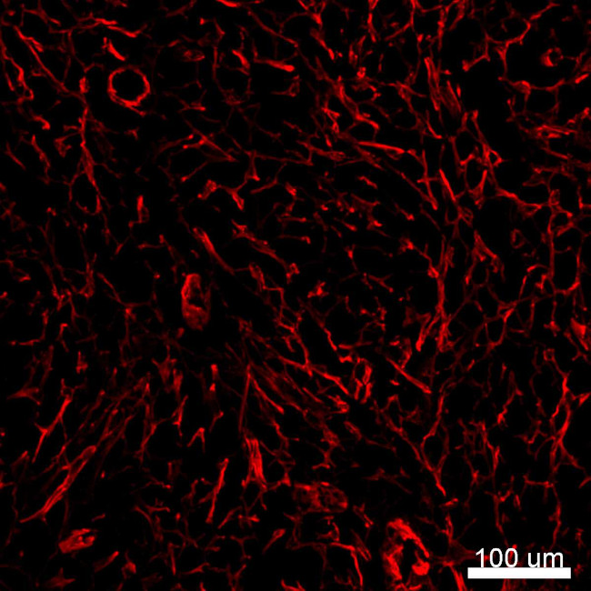 Alpha-Smooth Muscle Actin Antibody in Immunohistochemistry (IHC)