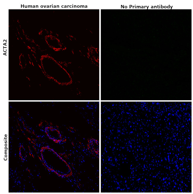 Alpha-Smooth Muscle Actin Antibody in Immunohistochemistry (Paraffin) (IHC (P))