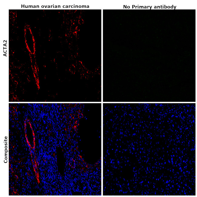 Alpha-Smooth Muscle Actin Antibody in Immunohistochemistry (Paraffin) (IHC (P))