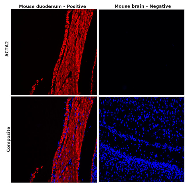 Alpha-Smooth Muscle Actin Antibody in Immunohistochemistry (Paraffin) (IHC (P))