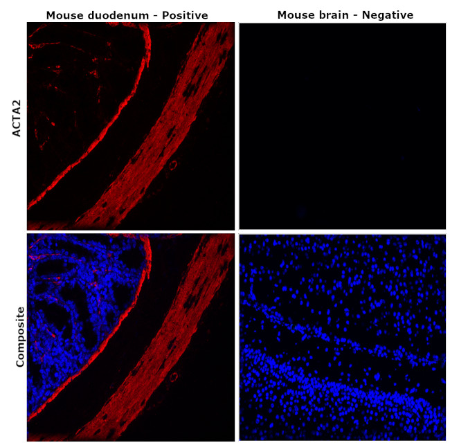 Alpha-Smooth Muscle Actin Antibody in Immunohistochemistry (Paraffin) (IHC (P))