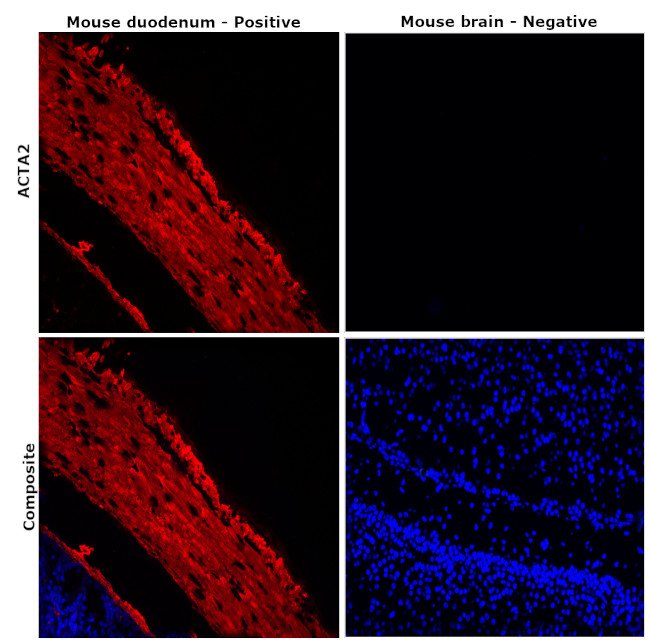 Alpha-Smooth Muscle Actin Antibody in Immunohistochemistry (Paraffin) (IHC (P))