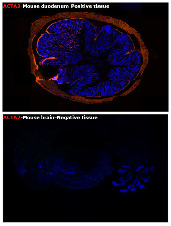 Alpha-Smooth Muscle Actin Antibody in Immunohistochemistry (Paraffin) (IHC (P))