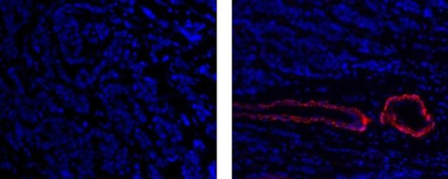 Alpha-Smooth Muscle Actin Antibody in Immunohistochemistry (Paraffin) (IHC (P))