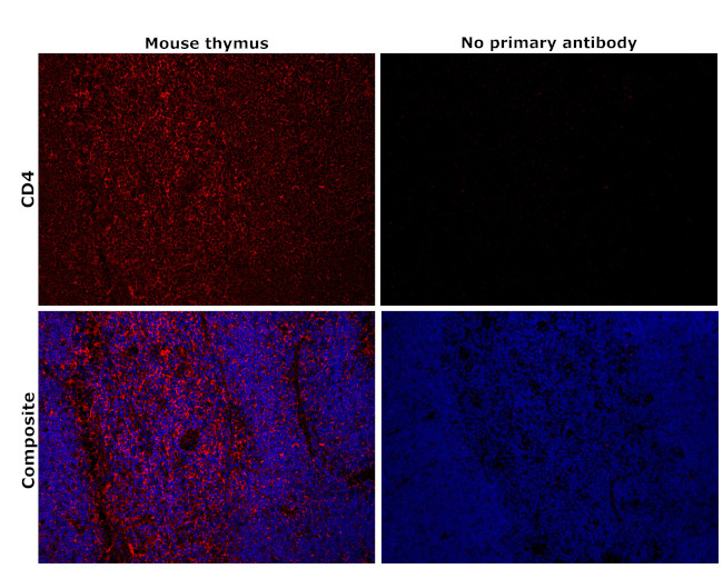 CD4 Antibody in Immunohistochemistry (Paraffin) (IHC (P))