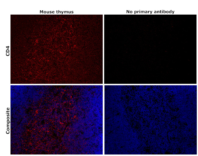 CD4 Antibody in Immunohistochemistry (Paraffin) (IHC (P))