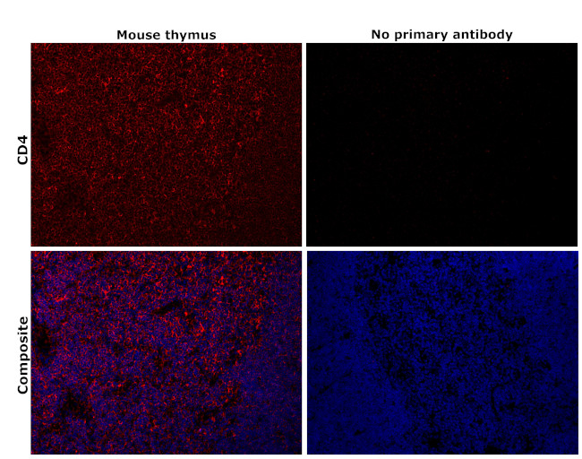 CD4 Antibody in Immunohistochemistry (Paraffin) (IHC (P))