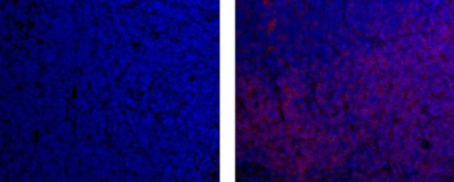 CD4 Antibody in Immunohistochemistry (Paraffin) (IHC (P))