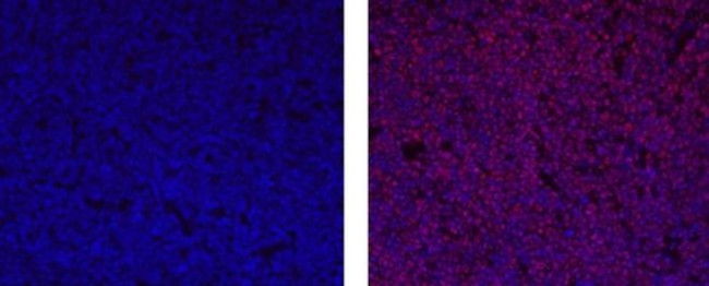 SOX11 Antibody in Immunohistochemistry (Paraffin) (IHC (P))