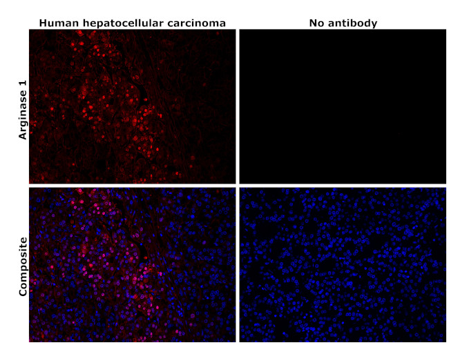 Arginase 1 Antibody in Immunohistochemistry (Paraffin) (IHC (P))