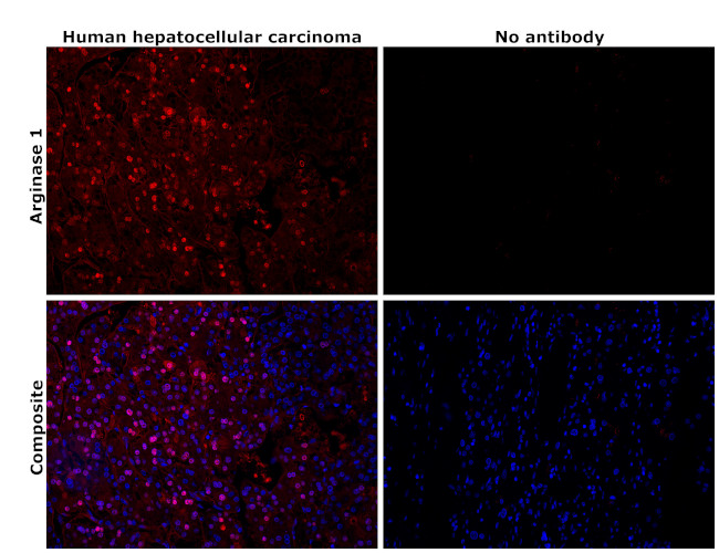 Arginase 1 Antibody in Immunohistochemistry (Paraffin) (IHC (P))