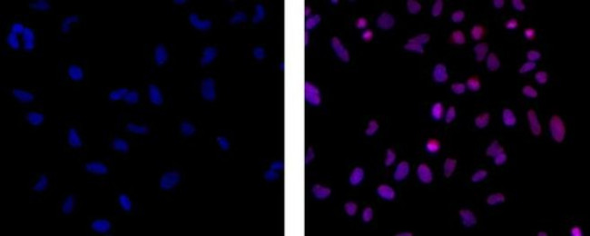 EZH2 Antibody in Immunocytochemistry (ICC/IF)