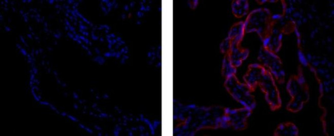 Placental Alkaline Phosphatase Antibody in Immunohistochemistry (Paraffin) (IHC (P))