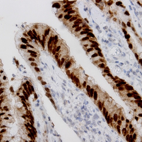 PID/MTA2 Antibody in Immunohistochemistry (Paraffin) (IHC (P))