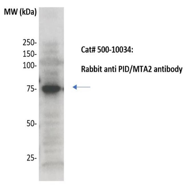 PID/MTA2 Antibody in Western Blot (WB)