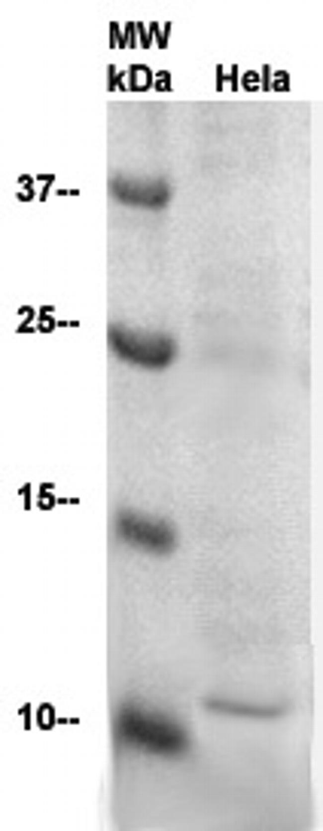 SUMO-2/Sentrin-2 Antibody in Western Blot (WB)