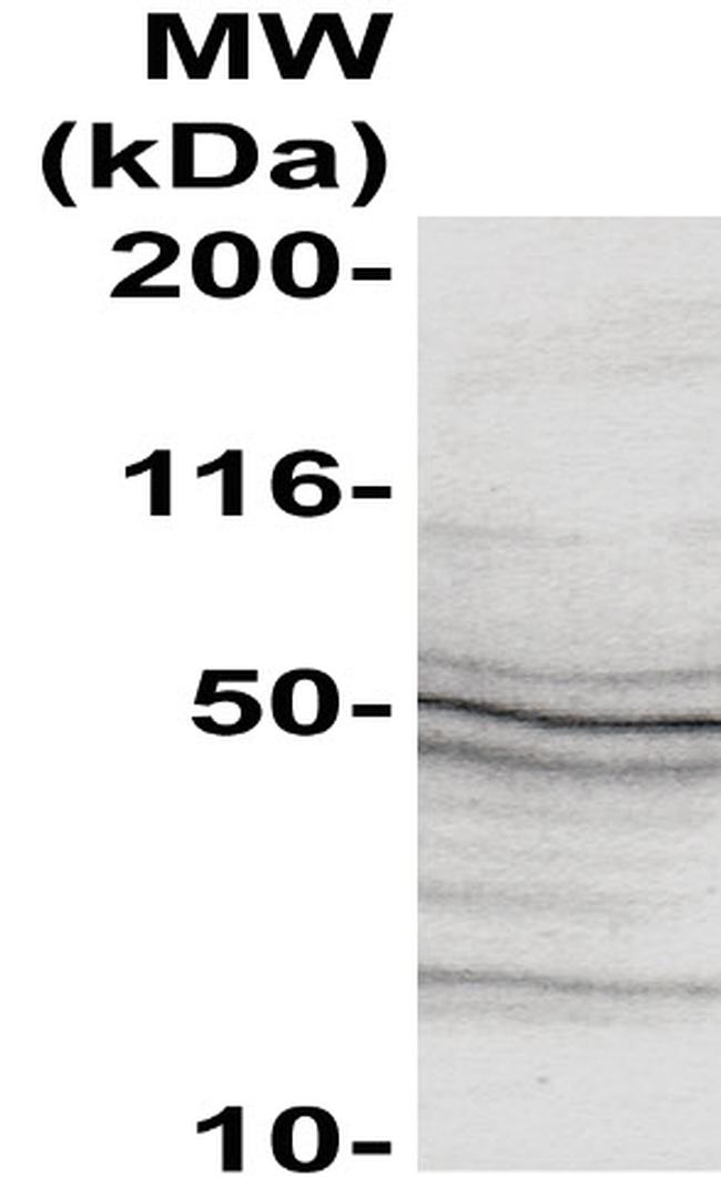 Caspase 10 Antibody in Western Blot (WB)