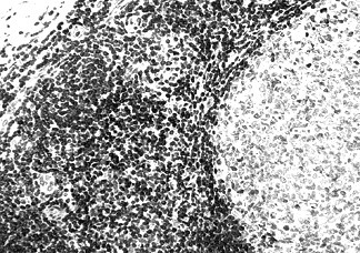 Bcl-2a Antibody in Immunohistochemistry (Paraffin) (IHC (P))