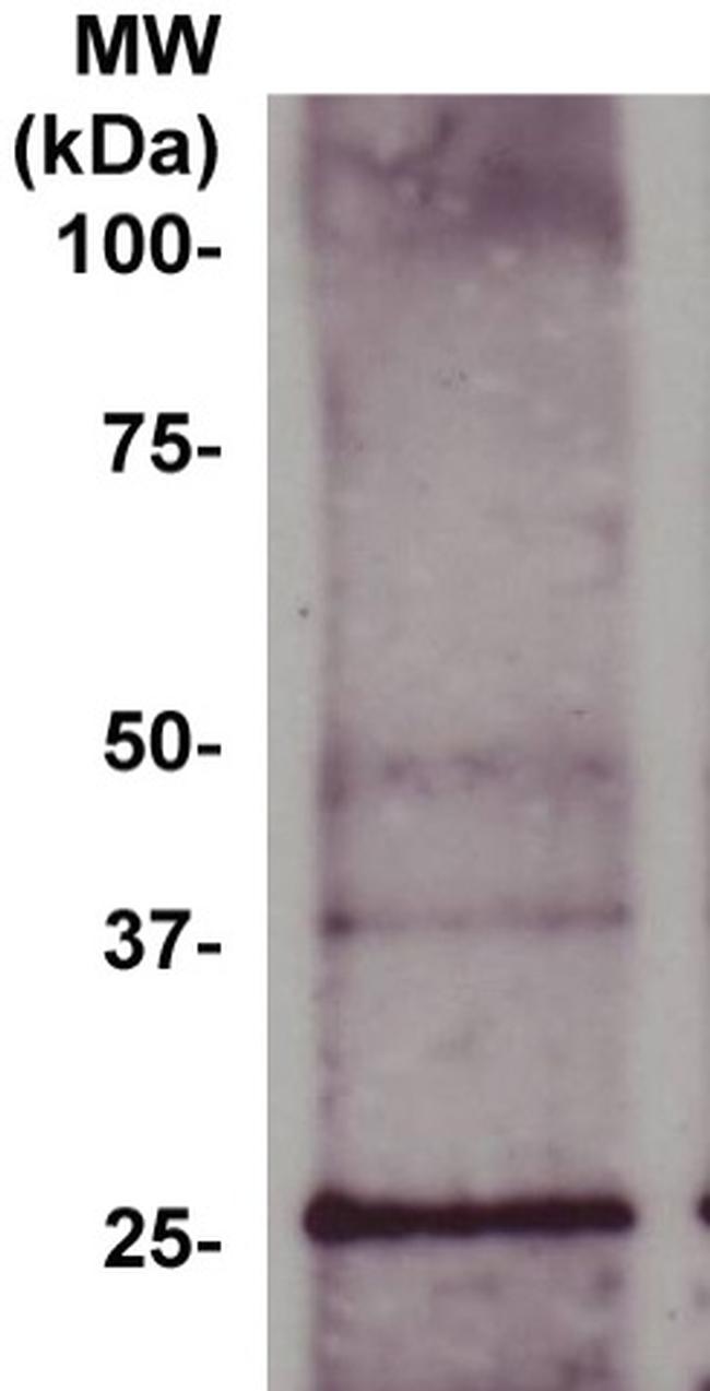 Bcl-2a Antibody in Western Blot (WB)