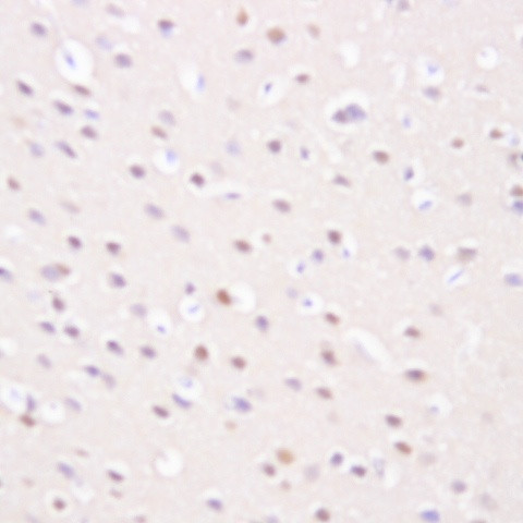 amyloid Antibody in Immunohistochemistry (Paraffin) (IHC (P))