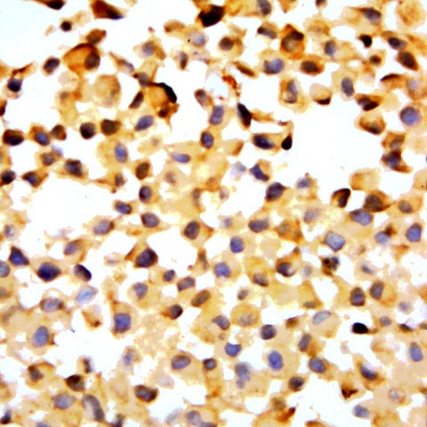 Phospho-ELK1 (Thr417) Antibody in Immunocytochemistry (ICC/IF)