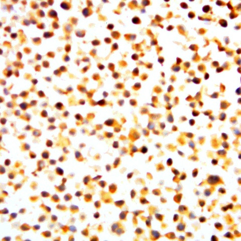 Phospho-NF-kB p105/p50 (Ser893) Antibody in Immunocytochemistry (ICC/IF)