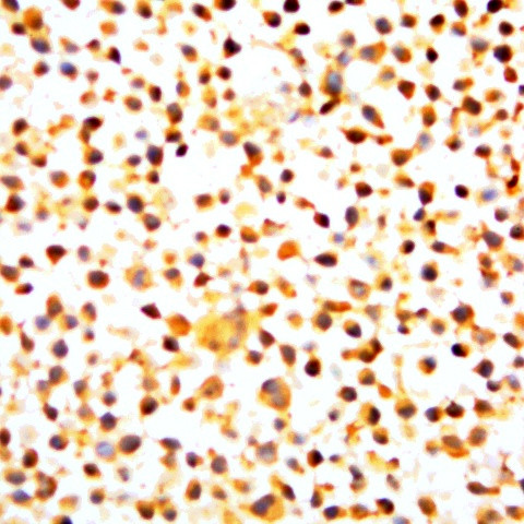 Phospho-NF-kB p105/p50 (Ser907) Antibody in Immunocytochemistry (ICC/IF)