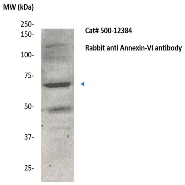 Annexin VI Antibody in Western Blot (WB)