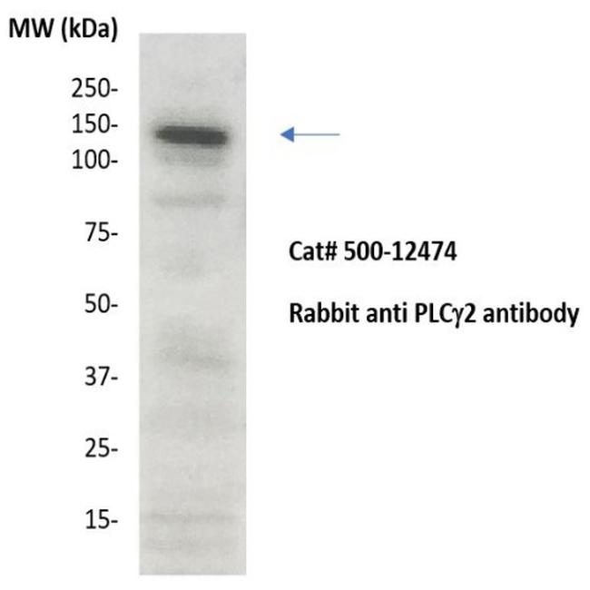 PLC gamma2 Antibody in Western Blot (WB)