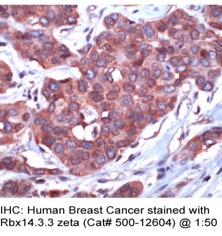 14-3-3 zeta Antibody in Immunohistochemistry (Paraffin) (IHC (P))