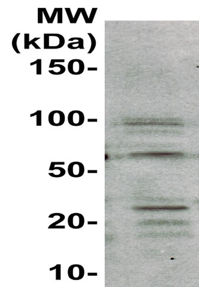 Collagen I Antibody in Western Blot (WB)