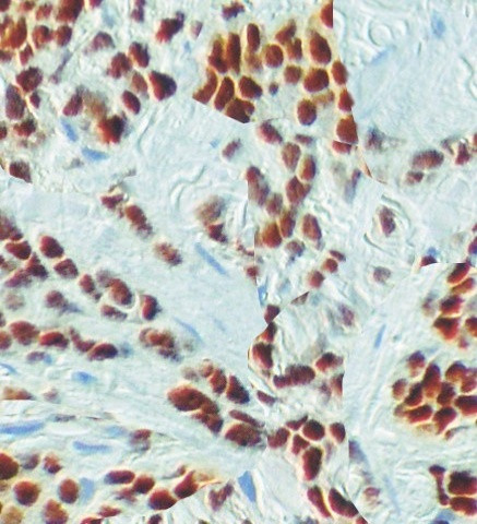 E2F2 Antibody in Immunohistochemistry (Paraffin) (IHC (P))