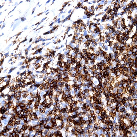 CD57 Antibody in Immunohistochemistry (Paraffin) (IHC (P))