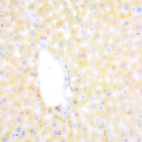 Hepatitis B virus core Ag Antibody in Immunohistochemistry (Paraffin) (IHC (P))