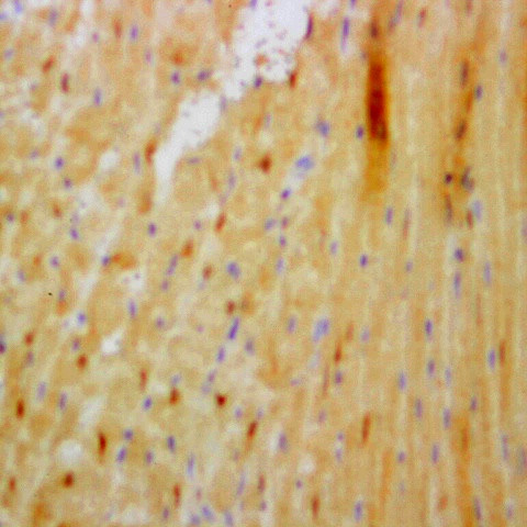 Hepatitis B virus surface Ag Antibody in Immunohistochemistry (Paraffin) (IHC (P))