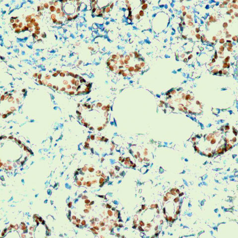 Progesterone Receptor (PR) Antibody in Immunohistochemistry (PFA fixed) (IHC (PFA))