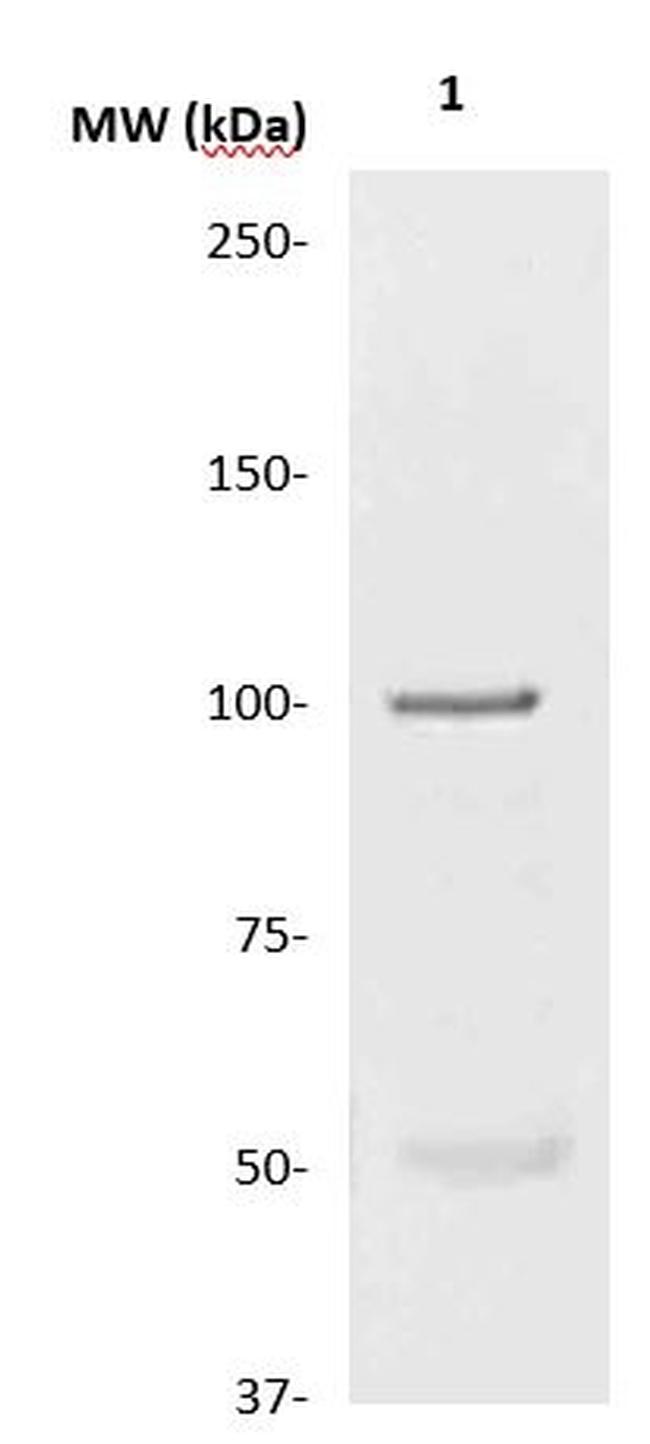 Progesterone Receptor (PR) Antibody in Western Blot (WB)