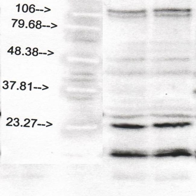 S100 Antibody in Western Blot (WB)