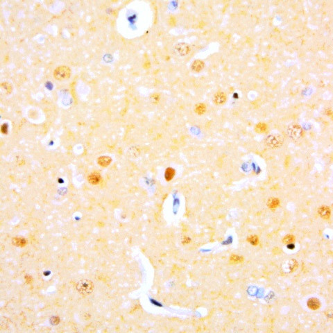 Somatostatin Antibody in Immunohistochemistry (Paraffin) (IHC (P))