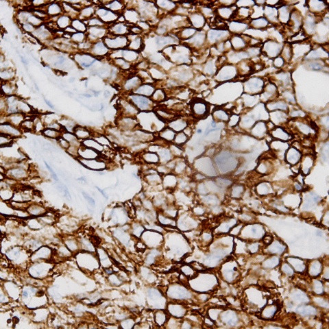 Cadherin (pan) Antibody in Immunohistochemistry (Paraffin) (IHC (P))